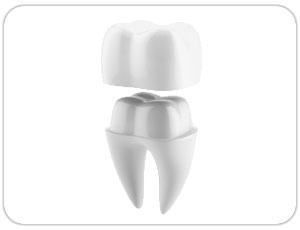 dental crown - dental cap - toronto, on dentist