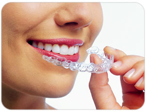 invisalign clear braces toronto west village dental clinic