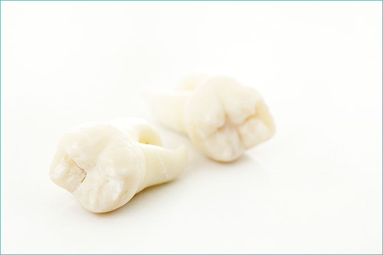 wisdom tooth extraction in toronto - west village dental clinic - dr. triassi