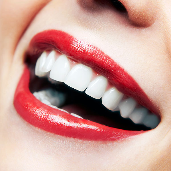 healthy teeth toronto dentist west village dental