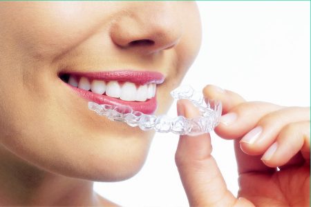 invisalign clear braces toronto west village dental clinic