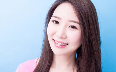 How To Keep Your Teeth Clean With Dental Braces
