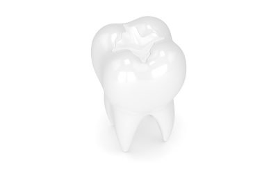 Should Your Child Get Dental Sealants?